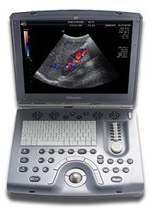 GE Voluson e Portable Ultrasound