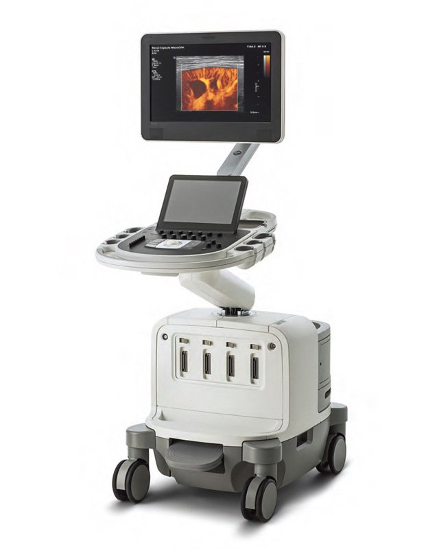 Philips Epiq 5 Ultrasound System
