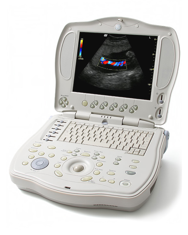 GE Logiq Book Ultrasound Machine