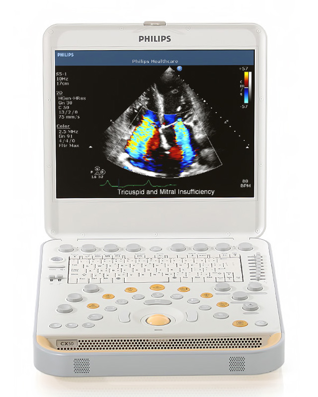 Philips CX50 Ultrasound Machine