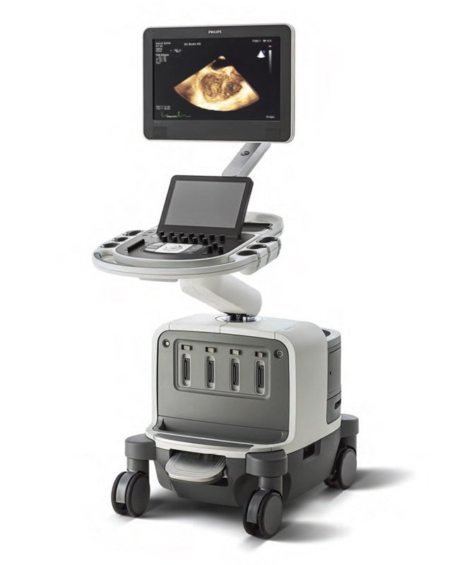 Philips Epiq 7 Ultrasound System